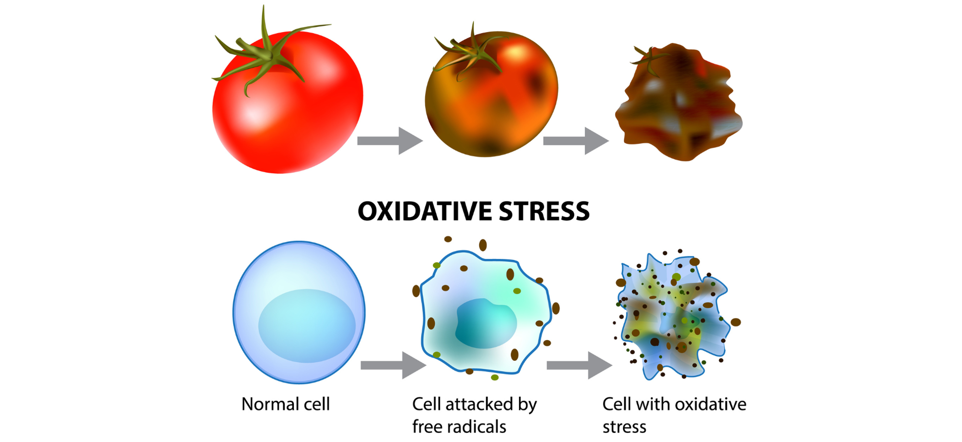 stress oxydatif