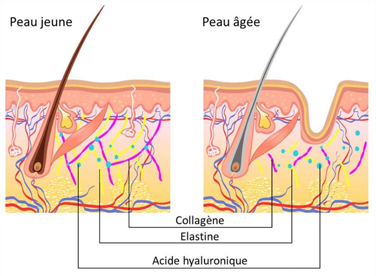 Avec l'âge, la structure de la peau est altérée et la quantité de collagène diminue.